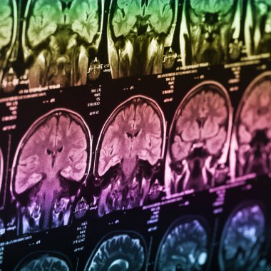 İnsan beyninin, portre resim tıbbi x-ray