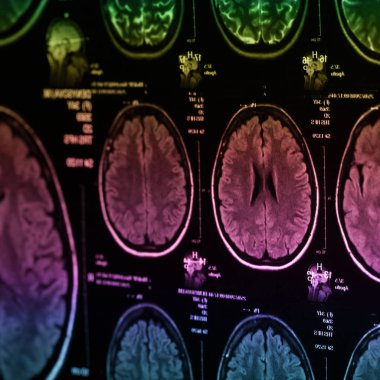 İnsan beyninin, portre resim tıbbi x-ray