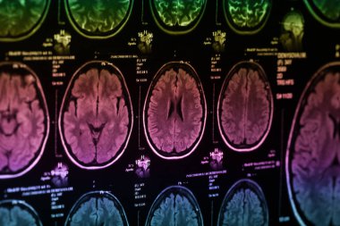 İnsan beyninin, portre resim tıbbi x-ray