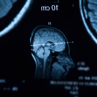 İnsan beyninin, portre resim tıbbi x-ray