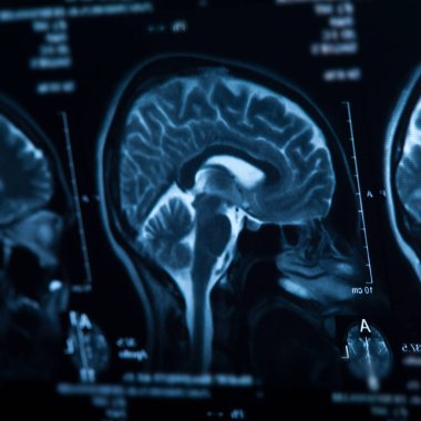 İnsan beyninin, portre resim tıbbi x-ray