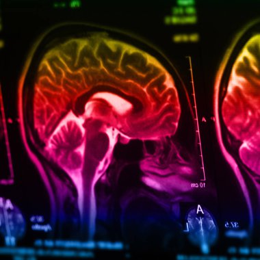 İnsan beyninin, portre resim tıbbi x-ray