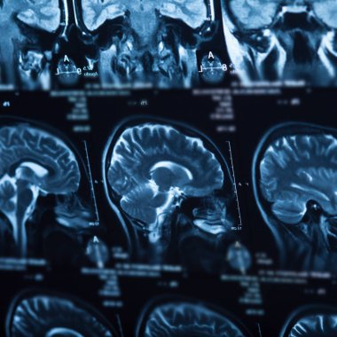 İnsan beyninin, portre resim tıbbi x-ray