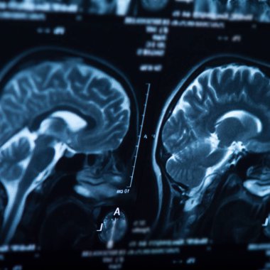 İnsan beyninin, portre resim tıbbi x-ray