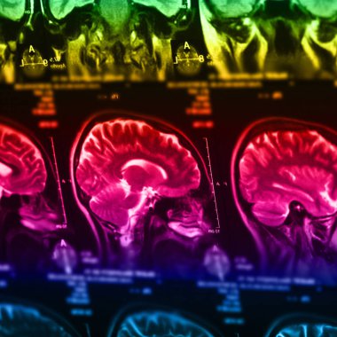 İnsan beyninin, portre resim tıbbi x-ray