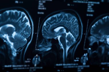 İnsan beyninin, portre resim tıbbi x-ray