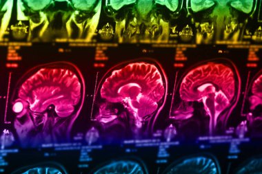 İnsan beyninin, portre resim tıbbi x-ray