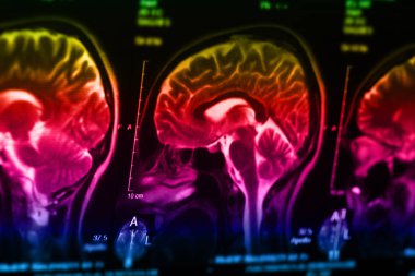 İnsan beyninin, portre resim tıbbi x-ray