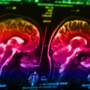 İnsan beyninin, portre resim tıbbi x-ray