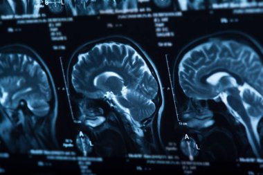 İnsan beyninin, portre resim tıbbi x-ray