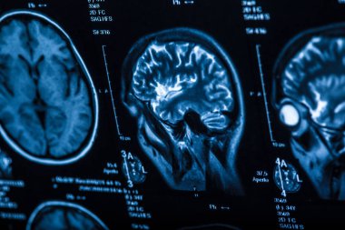 İnsan beyninin, portre resim tıbbi x-ray