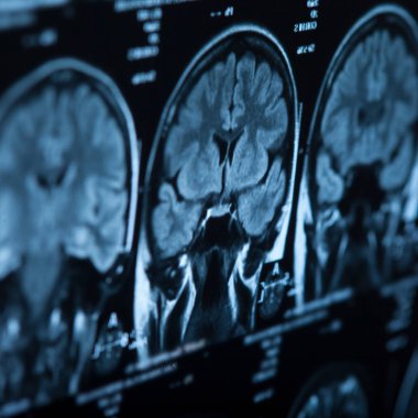 İnsan beyninin, portre resim tıbbi x-ray