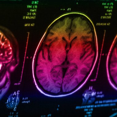 İnsan beyninin, portre resim tıbbi x-ray