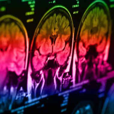 İnsan beyninin, portre resim tıbbi x-ray