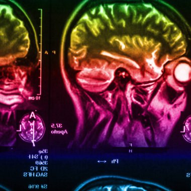 İnsan beyninin, portre resim tıbbi x-ray