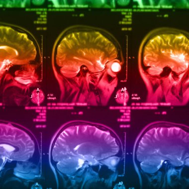 İnsan beyninin, portre resim tıbbi x-ray