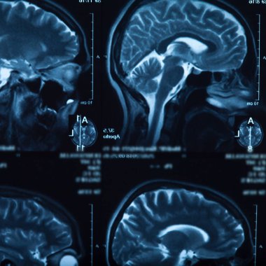 İnsan beyninin, portre resim tıbbi x-ray