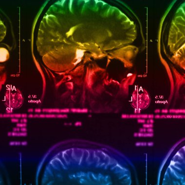 İnsan beyninin, portre resim tıbbi x-ray