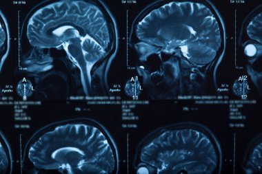 İnsan beyninin, portre resim tıbbi x-ray