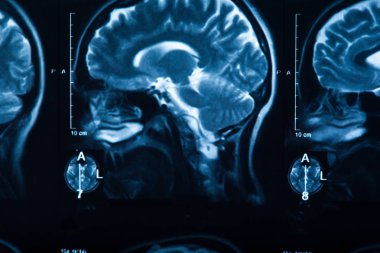 İnsan beyninin, portre resim tıbbi x-ray