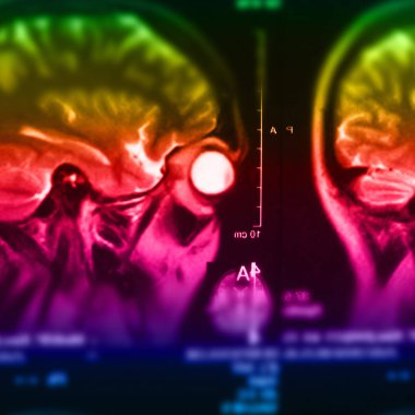 İnsan beyninin, portre resim tıbbi x-ray