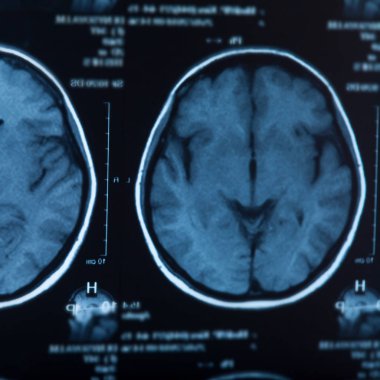 İnsan beyninin, portre resim tıbbi x-ray