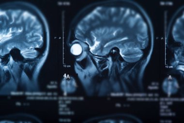 İnsan beyninin, portre resim tıbbi x-ray