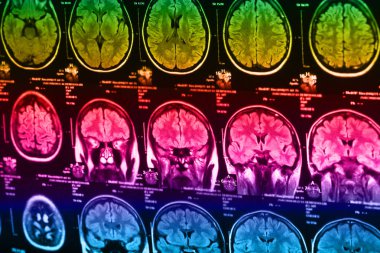 İnsan beyninin, portre resim tıbbi x-ray