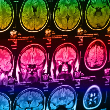 İnsan beyninin, portre resim tıbbi x-ray