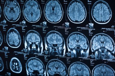 İnsan beyninin, portre resim tıbbi x-ray
