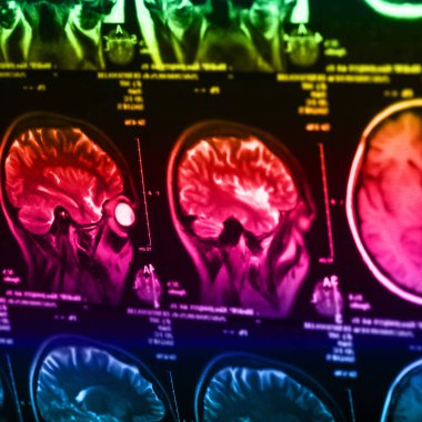 İnsan beyninin, portre resim tıbbi x-ray