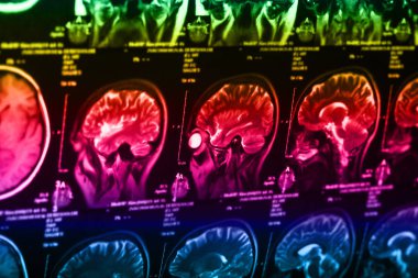 İnsan beyninin, portre resim tıbbi x-ray