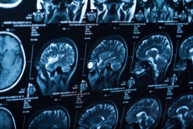 İnsan beyninin, portre resim tıbbi x-ray