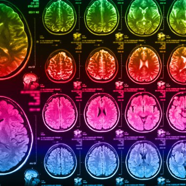 İnsan beyninin, portre resim tıbbi x-ray