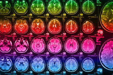 İnsan beyninin, portre resim tıbbi x-ray