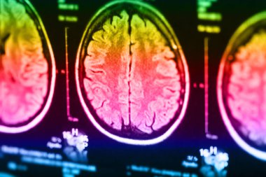 İnsan beyninin, portre resim tıbbi x-ray