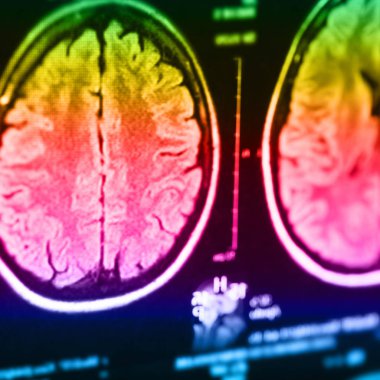 İnsan beyninin, portre resim tıbbi x-ray