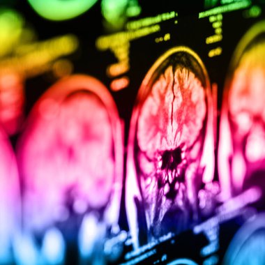 İnsan beyninin, portre resim tıbbi x-ray