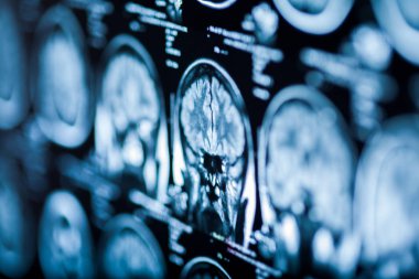 İnsan beyninin, portre resim tıbbi x-ray