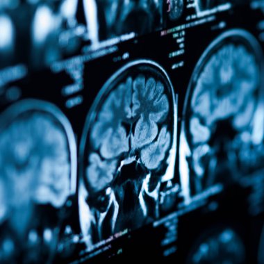 İnsan beyninin, portre resim tıbbi x-ray