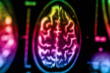 İnsan beyninin, portre resim tıbbi x-ray