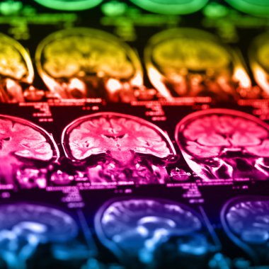 İnsan beyninin, portre resim tıbbi x-ray