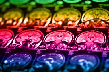 İnsan beyninin, portre resim tıbbi x-ray