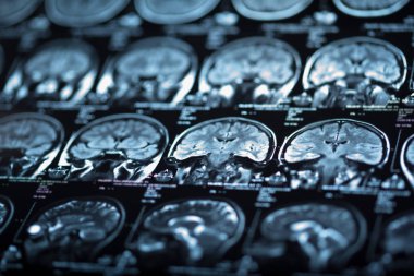 İnsan beyninin, portre resim tıbbi x-ray