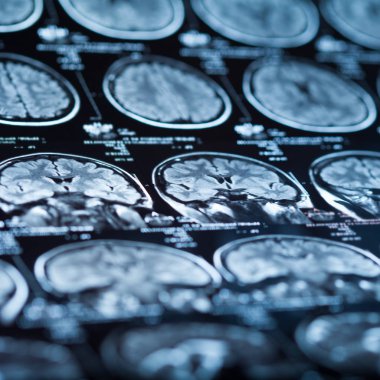 İnsan beyninin, portre resim tıbbi x-ray