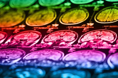 İnsan beyninin, portre resim tıbbi x-ray