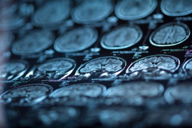 İnsan beyninin, portre resim tıbbi x-ray