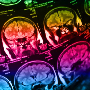 İnsan beyninin, portre resim tıbbi x-ray