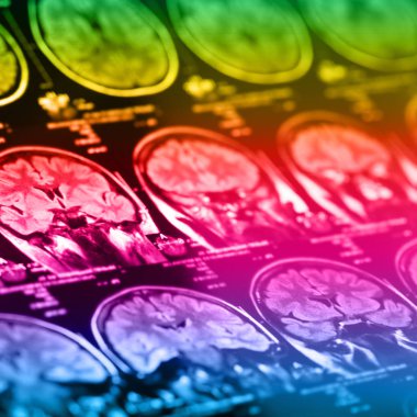 İnsan beyninin, portre resim tıbbi x-ray