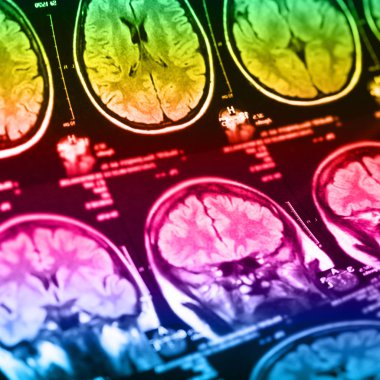 İnsan beyninin, portre resim tıbbi x-ray